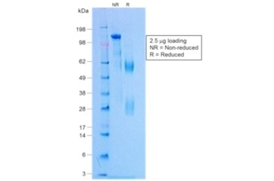 SDS-PAGE - Rabbit IgG [NCRBM/1520R] (A251004) - Antibodies.com
