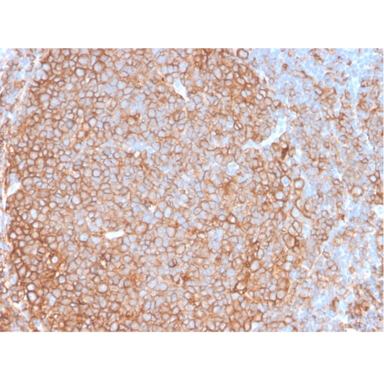 Immunohistochemistry - Anti-HLA DP + DQ + DR Antibody [HLA-Pan/2967R] (A251006) - Antibodies.com