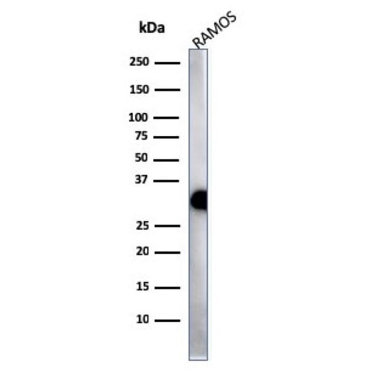 Western Blot - Anti-HLA DP + DQ + DR Antibody [HLA-Pan/2967R] (A251006) - Antibodies.com