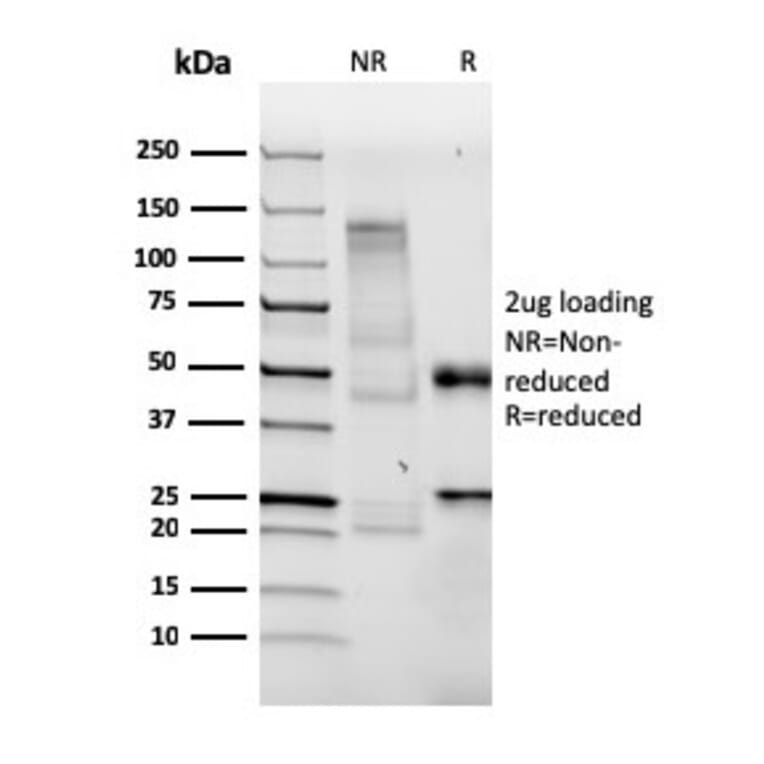 SDS-PAGE - Anti-BrdU Antibody [BRDU/3902R] (A251006) - Antibodies.com