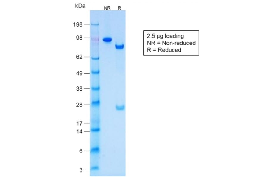 SDS-PAGE - Anti-Keratin 77 Antibody [KRTL/1577R] (A251008) - Antibodies.com