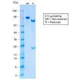 SDS-PAGE - Anti-Keratin 77 Antibody [KRTL/1577R] (A251008) - Antibodies.com