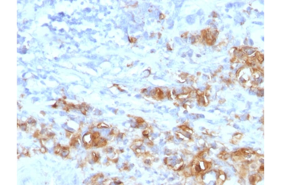 Immunohistochemistry - Anti-CA19-9 Antibody [CA19.9/1390R] (A251008) - Antibodies.com