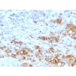 Immunohistochemistry - Anti-CA19-9 Antibody [CA19.9/1390R] (A251008) - Antibodies.com
