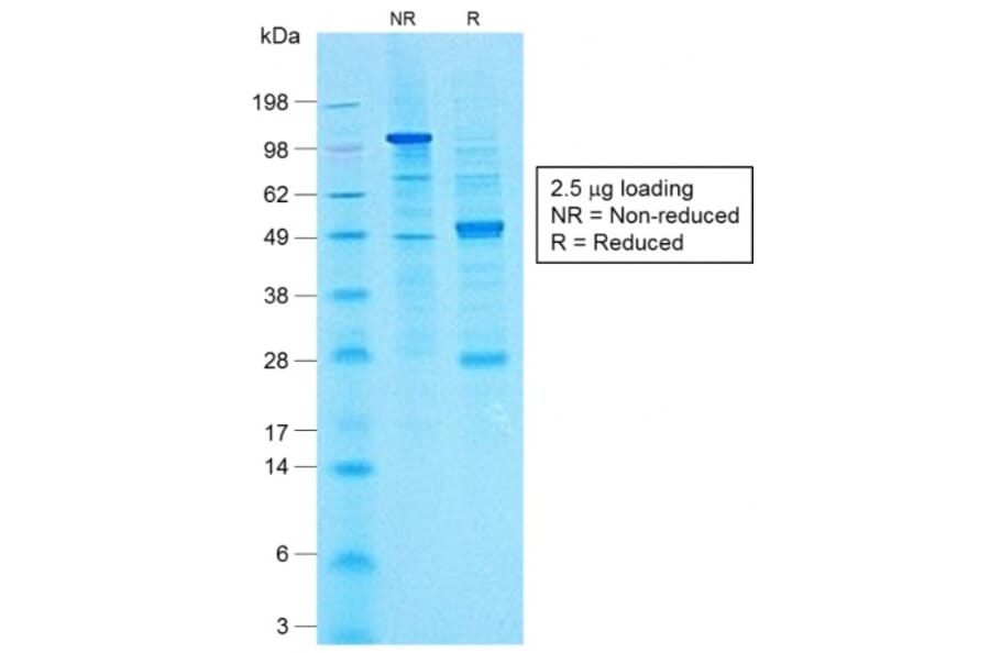SDS-PAGE - Anti-CA19-9 Antibody [CA19.9/1390R] (A251009) - Antibodies.com