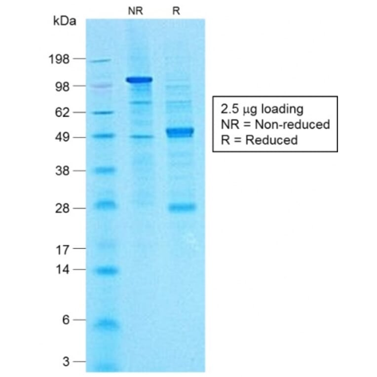 SDS-PAGE - Anti-CA19-9 Antibody [CA19.9/1390R] (A251009) - Antibodies.com
