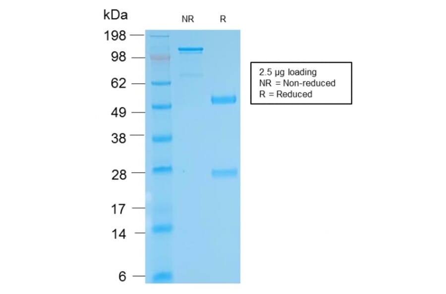 SDS-PAGE - Anti-Biotin Antibody [BTN/2032R] (A251010) - Antibodies.com