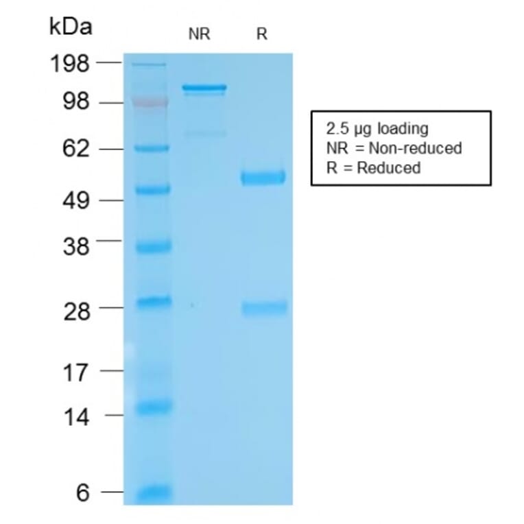 SDS-PAGE - Anti-Biotin Antibody [BTN/2032R] (A251010) - Antibodies.com