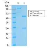 SDS-PAGE - Anti-Biotin Antibody [BTN/2032R] (A251010) - Antibodies.com