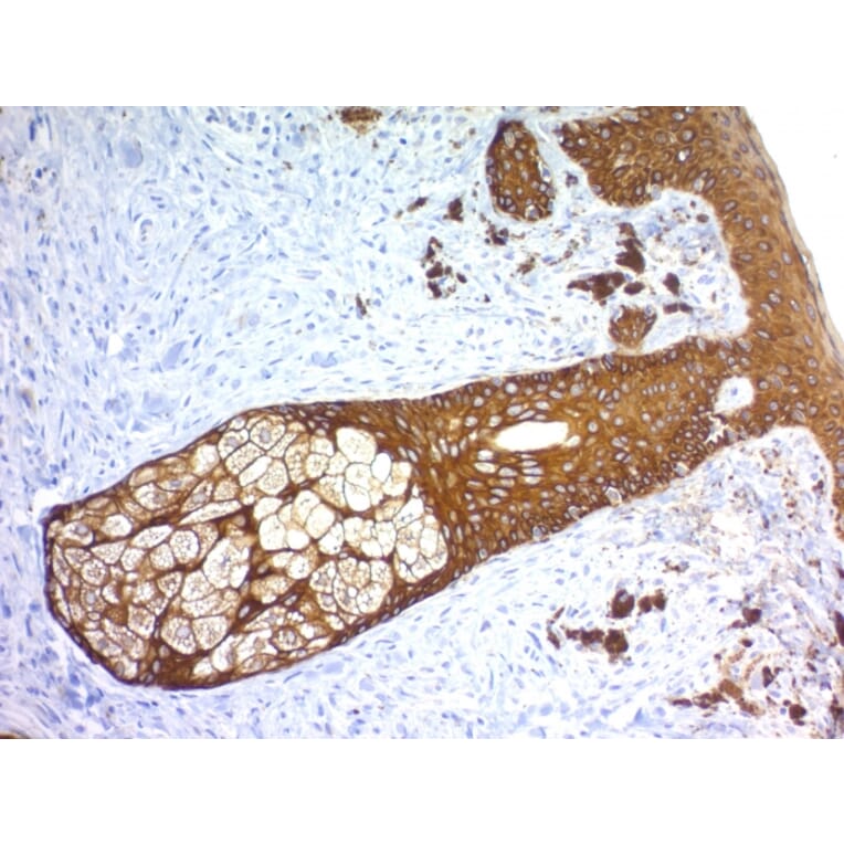 Immunohistochemistry - Anti-Keratin 76 Antibody [KRTH/1576R] (A251011) - Antibodies.com