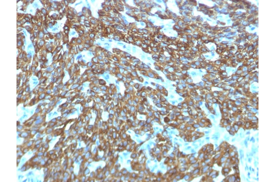 Immunohistochemistry - Anti-Keratin 76 Antibody [KRTH/1576R] (A251010) - Antibodies.com