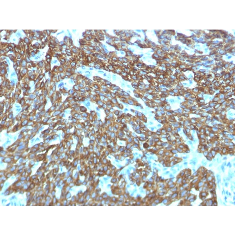 Immunohistochemistry - Anti-Keratin 76 Antibody [KRTH/1576R] (A251010) - Antibodies.com