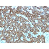 Immunohistochemistry - Anti-Keratin 76 Antibody [KRTH/1576R] (A251010) - Antibodies.com
