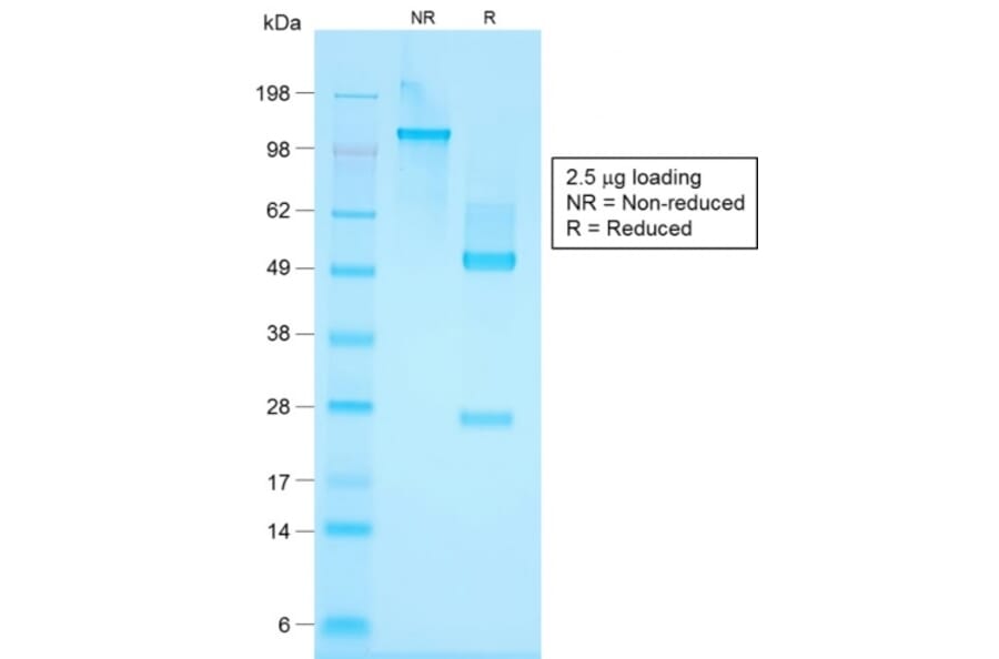 SDS-PAGE - Anti-Keratin 76 Antibody [KRTH/1576R] (A251011) - Antibodies.com
