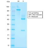 SDS-PAGE - Anti-Keratin 76 Antibody [KRTH/1576R] (A251011) - Antibodies.com