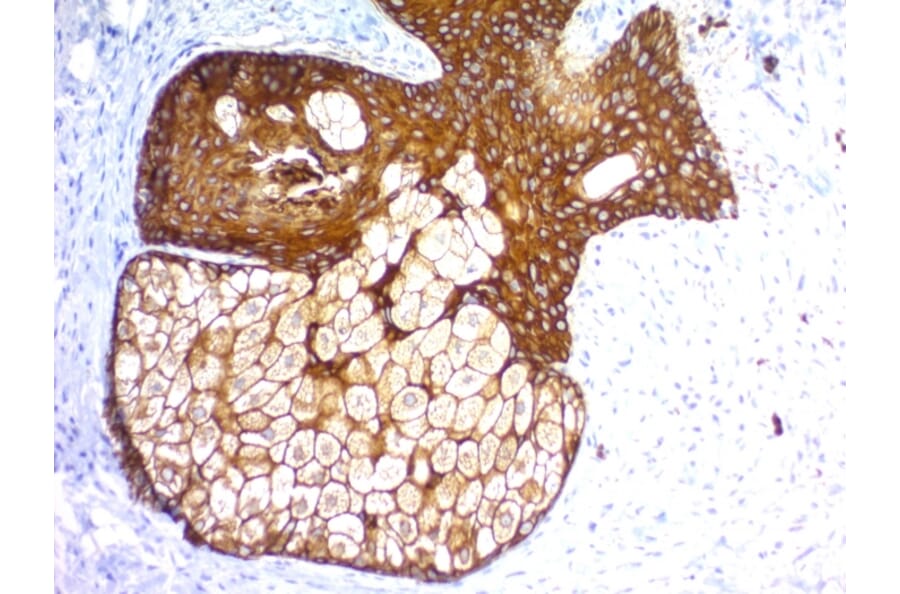 Immunohistochemistry - Anti-pan Cytokeratin Antibody [KRTH/1576R + KRTL/1577R] (A251011) - Antibodies.com