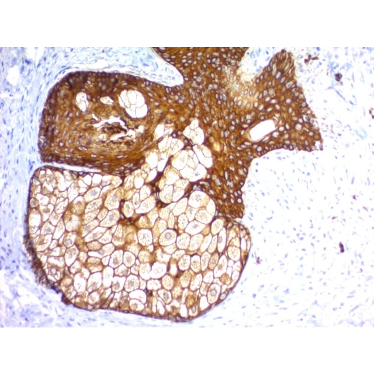 Immunohistochemistry - Anti-pan Cytokeratin Antibody [KRTH/1576R + KRTL/1577R] (A251011) - Antibodies.com