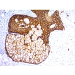 Immunohistochemistry - Anti-pan Cytokeratin Antibody [KRTH/1576R + KRTL/1577R] (A251011) - Antibodies.com