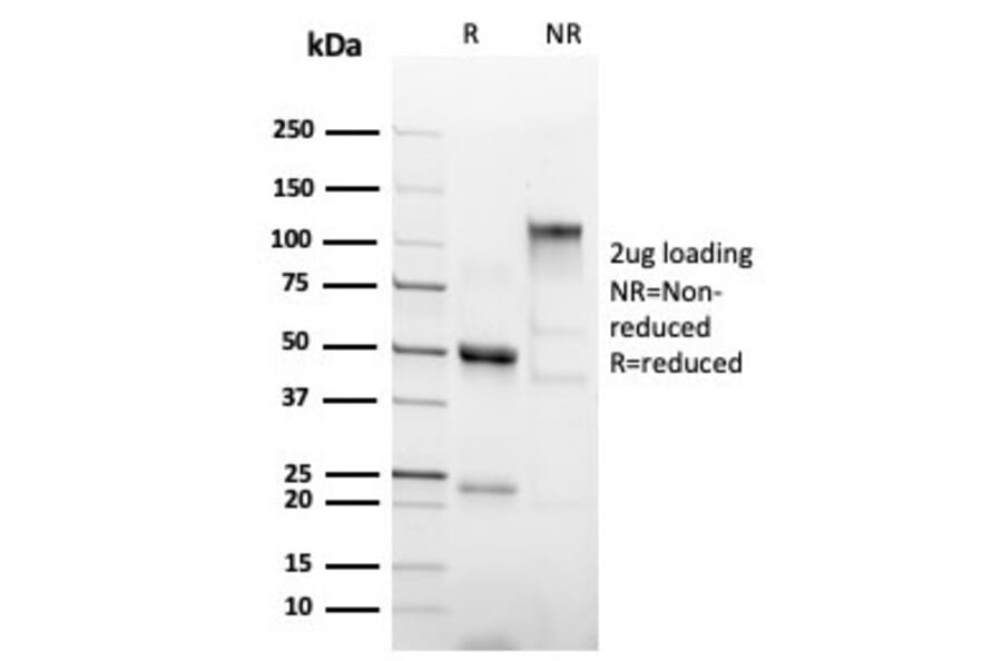 SDS-PAGE - Anti-His Tag Antibody [6HIS/6402R] (A251012) - Antibodies.com