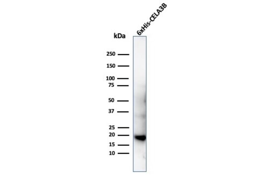 Western Blot - Anti-His Tag Antibody [6HIS/6402R] (A251013) - Antibodies.com