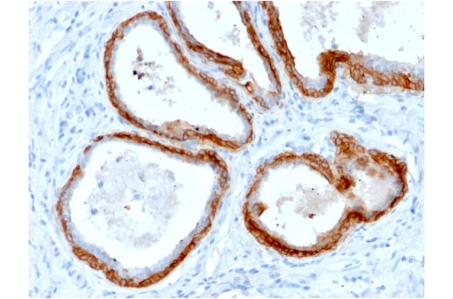 Immunohistochemistry - Anti-Keratin 76 Antibody [KRTH/2147R] (A254137) - Antibodies.com
