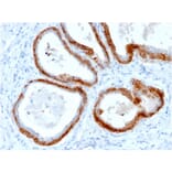 Immunohistochemistry - Anti-Keratin 76 Antibody [KRTH/2147R] (A254137) - Antibodies.com