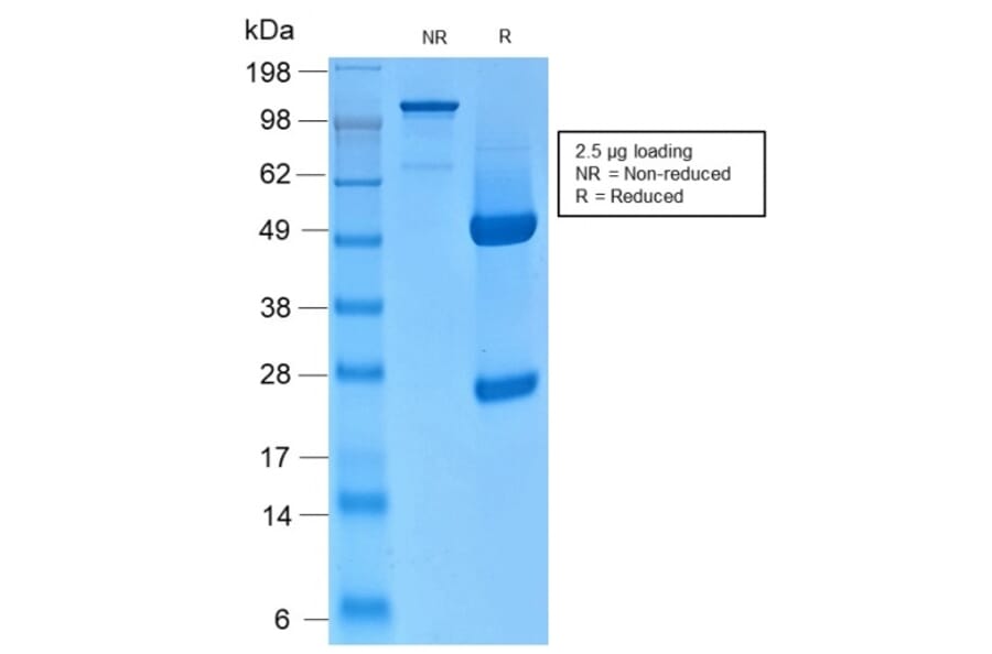 SDS-PAGE - Anti-Keratin 76 Antibody [KRTH/2147R] (A254190) - Antibodies.com
