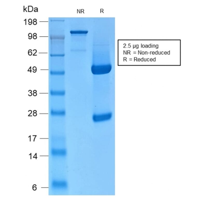 SDS-PAGE - Anti-Keratin 76 Antibody [KRTH/2147R] (A254190) - Antibodies.com
