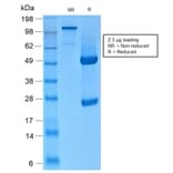 SDS-PAGE - Anti-Keratin 76 Antibody [KRTH/2147R] (A254190) - Antibodies.com