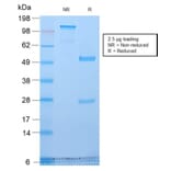 SDS-PAGE - Anti-Golgi Complex Antibody [GLG1/2829R] (A251015) - Antibodies.com