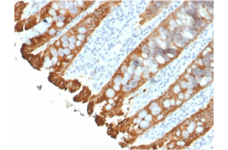 Immunohistochemistry - Anti-Cytokeratin 8 + 18 Antibody [KRT8.18/2297R] (A251015) - Antibodies.com