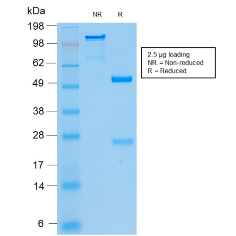 SDS-PAGE - Anti-Cytokeratin 8 + 18 Antibody [KRT8.18/2297R] (A251016) - Antibodies.com