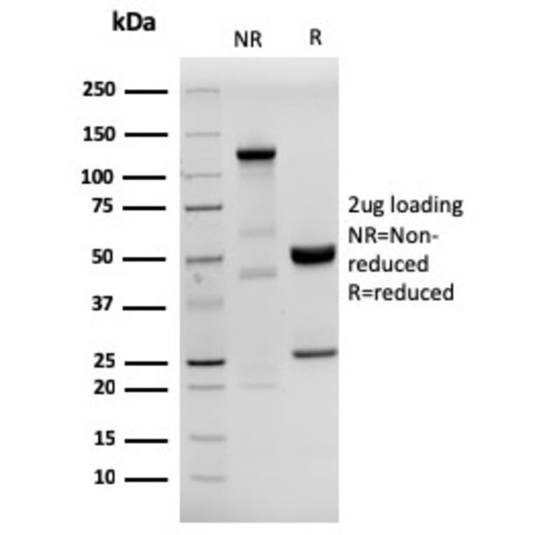 SDS-PAGE - Anti-HHV8 LNA-1 Antibody [HHV8/3633R] (A251017) - Antibodies.com