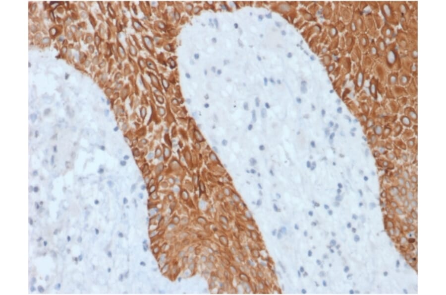 Immunohistochemistry - Anti-pan Cytokeratin Antibody [KRT/1877R] (A251018) - Antibodies.com