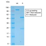 SDS-PAGE - Anti-pan Cytokeratin Antibody [KRT/1877R] (A251018) - Antibodies.com