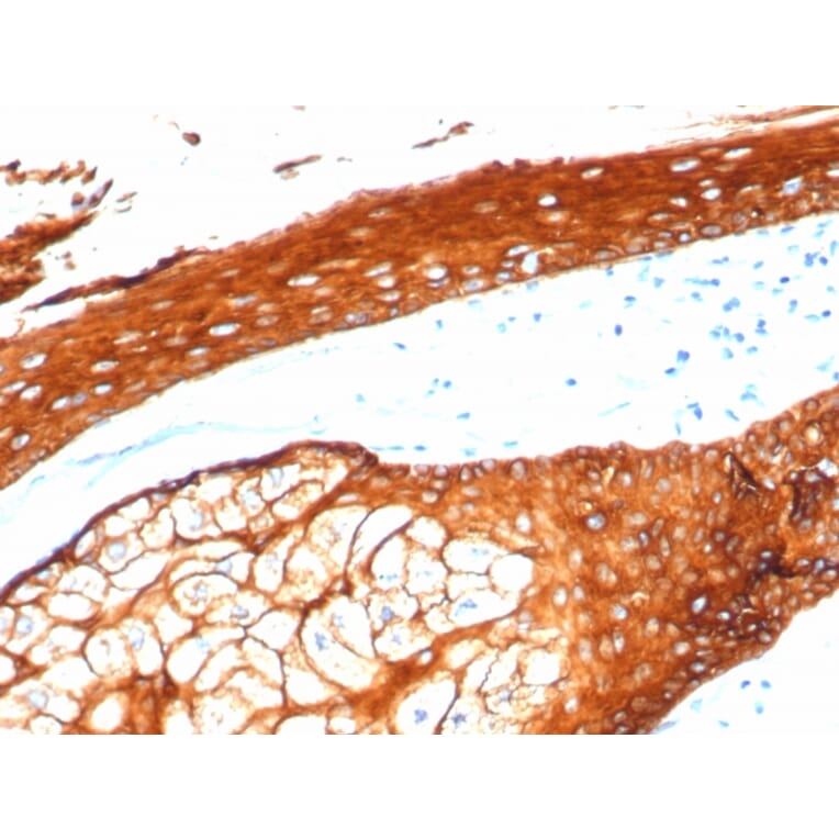 Immunohistochemistry - Anti-Keratin 76 Antibody [KRTH/4392R] (A251019) - Antibodies.com