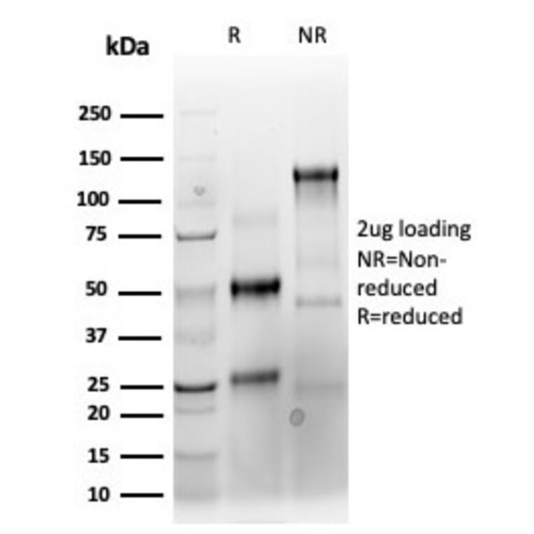 SDS-PAGE - Anti-Keratin 76 Antibody [KRTH/4392R] (A254193) - Antibodies.com