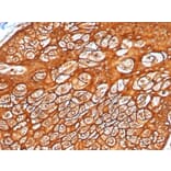 Immunohistochemistry - Anti-Keratin 77 Antibody [KRTL/4440R] (A251020) - Antibodies.com