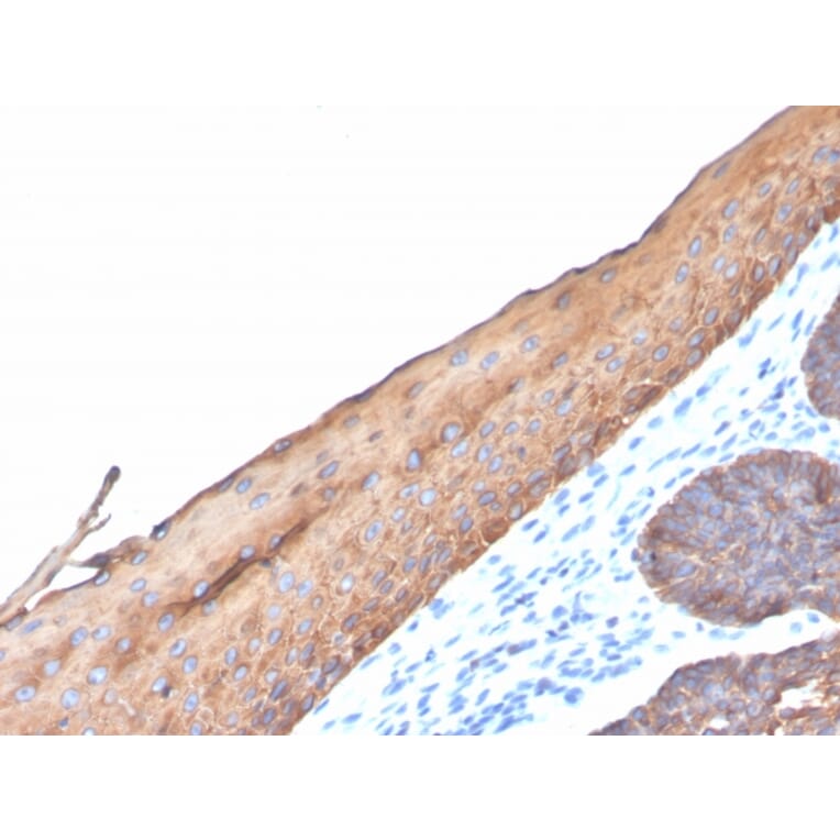 Immunohistochemistry - Anti-Keratin 77 Antibody [KRTL/4440R] (A251020) - Antibodies.com