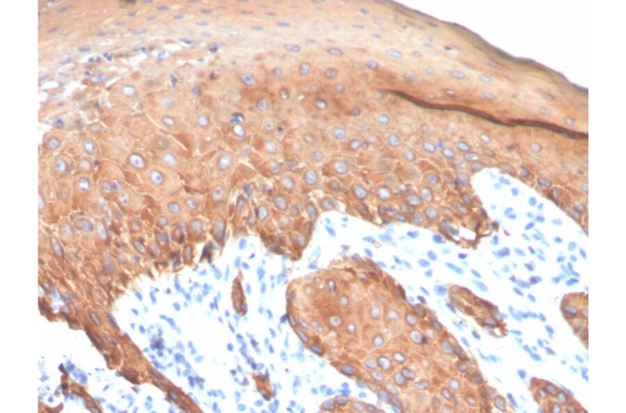Immunohistochemistry - Anti-Keratin 77 Antibody [KRTL/4440R] (A251019) - Antibodies.com