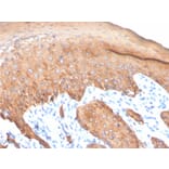 Immunohistochemistry - Anti-Keratin 77 Antibody [KRTL/4440R] (A251019) - Antibodies.com