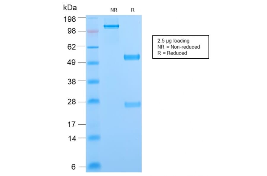 SDS-PAGE - Anti-Phosphotyrosine Antibody [PY2870R] (A251020) - Antibodies.com