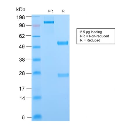 SDS-PAGE - Anti-Phosphotyrosine Antibody [PY2870R] (A251020) - Antibodies.com