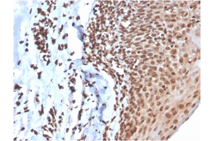 Immunohistochemistry - Anti-ds DNA Antibody [DSD/4054R] (A251022) - Antibodies.com