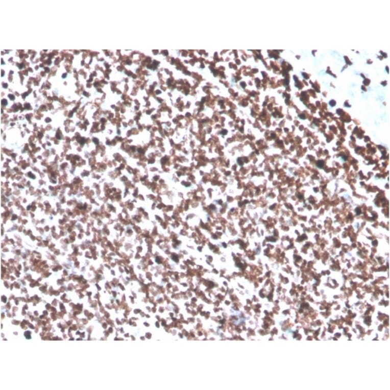 Immunohistochemistry - Anti-ds DNA Antibody [DSD/4054R] (A251021) - Antibodies.com