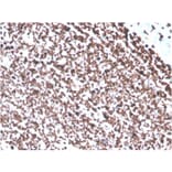 Immunohistochemistry - Anti-ds DNA Antibody [DSD/4054R] (A251021) - Antibodies.com