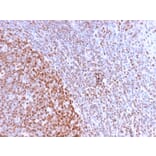 Immunohistochemistry - Anti-Nuclear Antigen Antibody [NM2984R] (A251023) - Antibodies.com