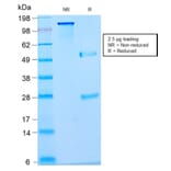 SDS-PAGE - Anti-Nuclear Antigen Antibody [NM2984R] (A254148) - Antibodies.com