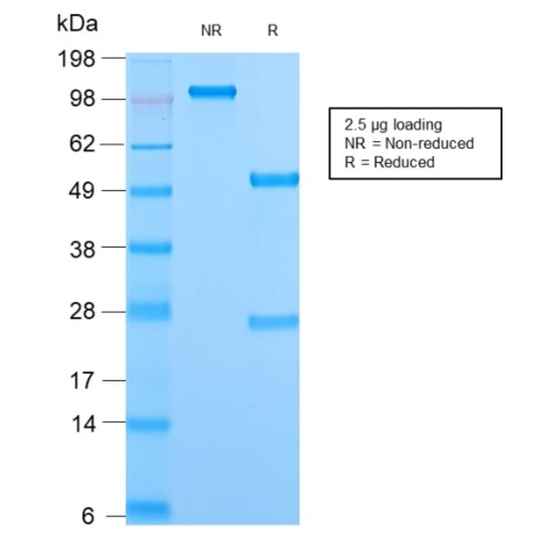 SDS-PAGE - Anti-Mitochondria Antibody [MTC02/2860R] (A251024) - Antibodies.com