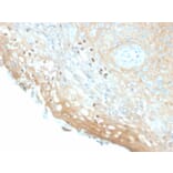 Immunohistochemistry - Anti-HPV16 L1 Antibody [HPV16/2058R] (A251024) - Antibodies.com
